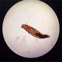 Truy tìm thủ phạm khiến vùng kín người đàn ông có 