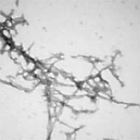 Phương pháp mới 