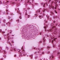 Dịch bệnh kỳ lạ bùng phát ở miền tây nước Mỹ khi thời tiết khô nóng