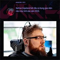 Người máy phiên bản đời thực: Người đàn ông này đã đeo giao diện não-máy tính hơn 7 năm