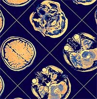 Nghiên cứu cho thấy: Não đàn ông co lại khi có con đầu lòng