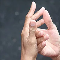 TP.HCM phát hiện ca đậu mùa khỉ đầu tiên