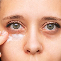 Tại sao ngủ đủ giấc nhưng mắt vẫn có quầng thâm?