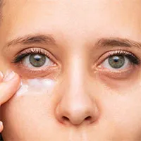 Tại sao ngủ đủ giấc nhưng mắt vẫn có quầng thâm?
