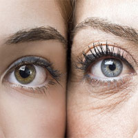 Sự lão hóa dưới góc nhìn khoa học