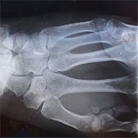 Bí ẩn những bộ xương khỏe nhất thế giới