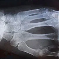 Bí ẩn những bộ xương khỏe nhất thế giới