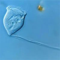 Cách đây 114 năm, vi sinh vật siêu hiếm đã được phát hiện