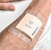 Ra mắt băng y tế thông minh xác định độ lành vết thương