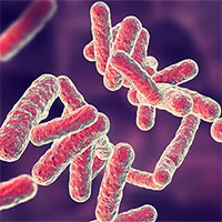 Đã xác định được nguyên nhân gây tử vong cao thứ hai trên thế giới, chỉ sau đột quỵ