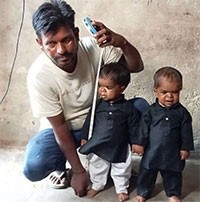 Bệnh bí ẩn khiến ba anh em Ấn Độ mãi như trẻ tập đi