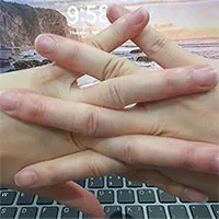 "Nghiện" bẻ khớp ngón tay, vặn cột sống, lắc cổ có gây thoái hóa sớm?
