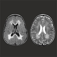Loại thuốc đắt nhất thế giới hoạt động thế nào?