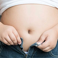 Những loại thực phẩm phổ biến gây béo bụng