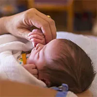 Hội chứng West là gì?