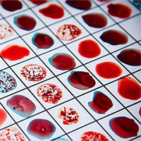 Chế độ dinh dưỡng tác động đến gene thế nào?