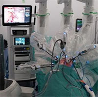 Robot giúp ghép phổi không cần cắt xương sườn