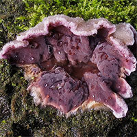 Người đầu tiên trên thế giới nhiễm nấm từ cây trồng