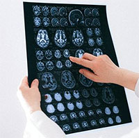 Điều độc đáo đằng sau bộ gene của người