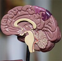 Hàng trăm người ở Canada mắc chứng rối loạn não bí ẩn