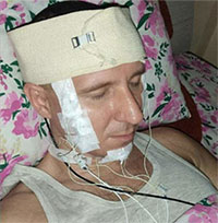 Nhà khoa học tuyên bố tự phẫu thuật não tại nhà