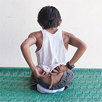 Tại sao một số người sinh ra có đuôi như động vật?