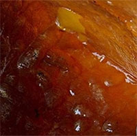 Đào giếng đụng trúng kho báu, cả nhà đổi đời sau một đêm