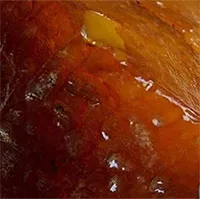 Đào giếng đụng trúng kho báu, cả nhà đổi đời sau một đêm