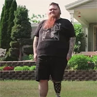 Căn bệnh khiến người phụ nữ có bộ râu dài nhất thế giới