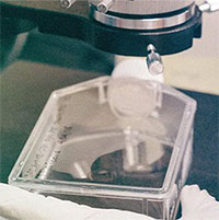 Bào thai mang đột biến gene hiếm gặp lần đầu tiên được phát hiện tại Việt Nam