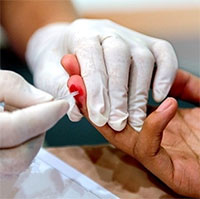 Ai được phép lấy mẫu xét nghiệm HIV?