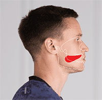 Mewing là gì? Tác dụng và cách tập mewing