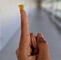 Cốc gắn trong má giúp truyền thuốc thay kim tiêm