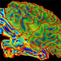 Mang thai có thể làm thay đổi cấu trúc não