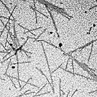 Virus đầu tiên được giới khoa học phát hiện là gì?