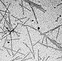 Virus đầu tiên được giới khoa học phát hiện là gì?
