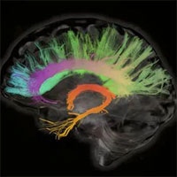 Chu kỳ kinh nguyệt làm thay đổi cấu trúc não