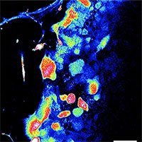 Phát hiện cơ quan xúc giác hoàn toàn mới ở người