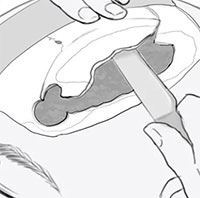 Ca phẫu thuật hộp sọ phức tạp 2.700 năm trước