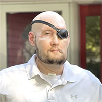 Ca ghép toàn bộ mắt đầu tiên trên thế giới: Bước đột phá gieo hạnh phúc!