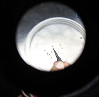 Mỹ phê duyệt vắc xin đầu tiên trên thế giới ngừa bệnh chikungunya do muỗi vằn