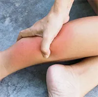 Bị nhức bắp chân là bệnh gì?