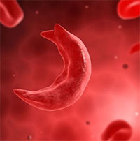 Anh phê duyệt thuốc chỉnh sửa gene đầu tiên trên thế giới