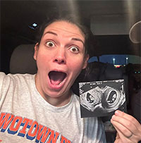 Thai phụ có 2 tử cung và đang mang 2 thai nhi