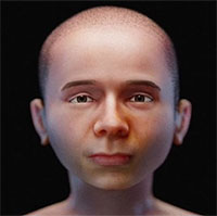 Chân dung xác ướp não to khác thường do bệnh hiếm