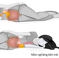 Tư thế ngủ giúp giảm khó tiêu, trào ngược