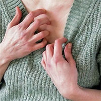 Vì sao mặc quần áo len hay bị ngứa?