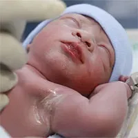 Em bé đầu tiên ở Việt Nam được sửa tim khi còn nằm trong bụng mẹ chào đời