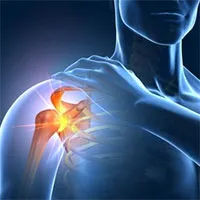 Vì sao phụ nữ mắc bệnh xương khớp cao hơn nam giới?