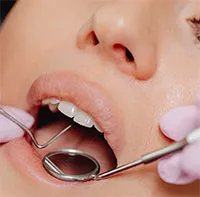 Những sự thật ít người biết về sâu răng